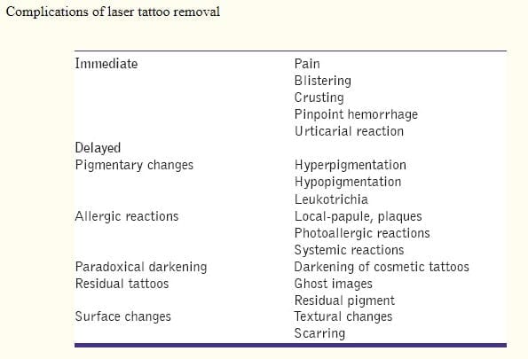 Pros and Cons of Laser Tattoo Removal