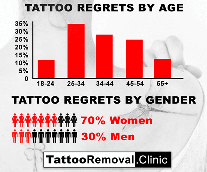 Tattoo Removal Devices Market Size Report 20222030