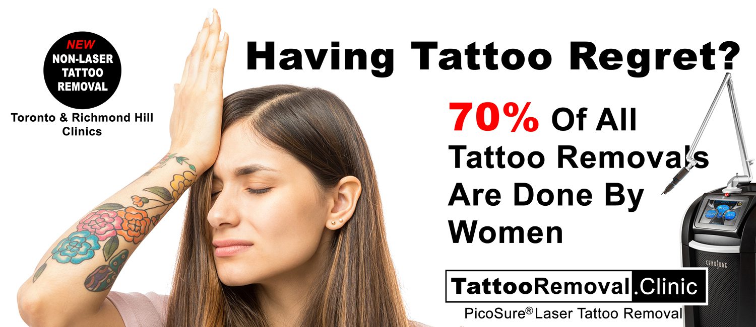 No Regrets Tattoo Removal  Laser Tattoo Removal based in Wizard Tattoo  Studio on Victoria Road Scarborough