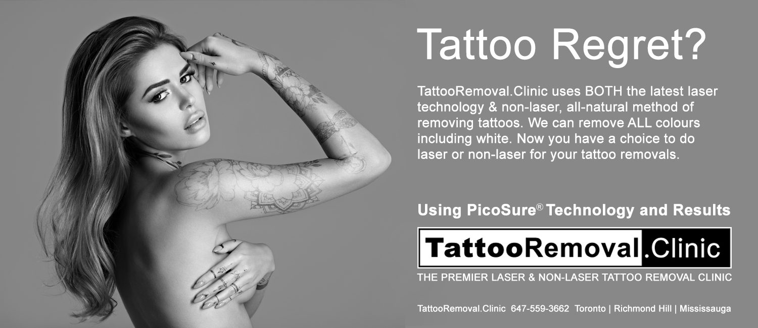 New ❤️$197 FLAT FEE Picosure Laser Tattoo Removal Toronto.