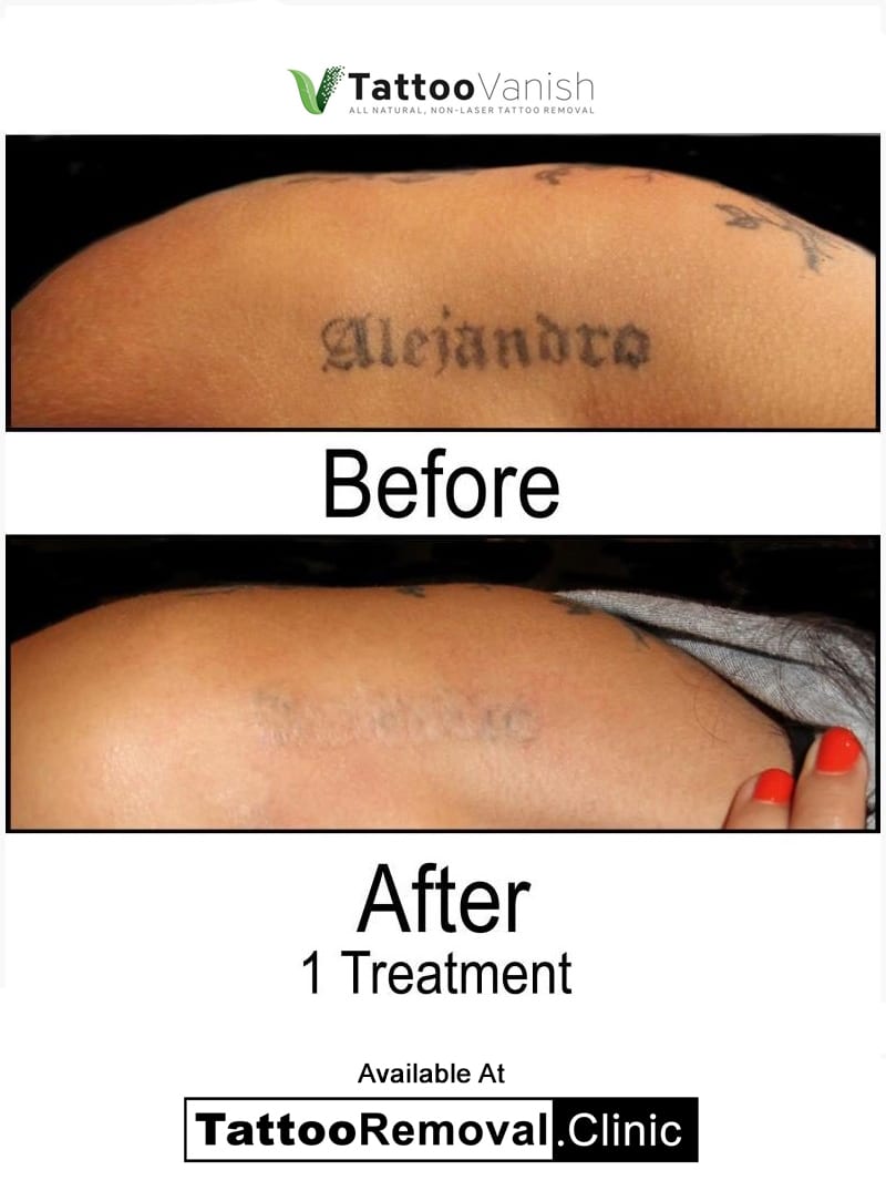 TATTOO VANISH | Tattoo Removal Cream | How to Fade A Tattoo.