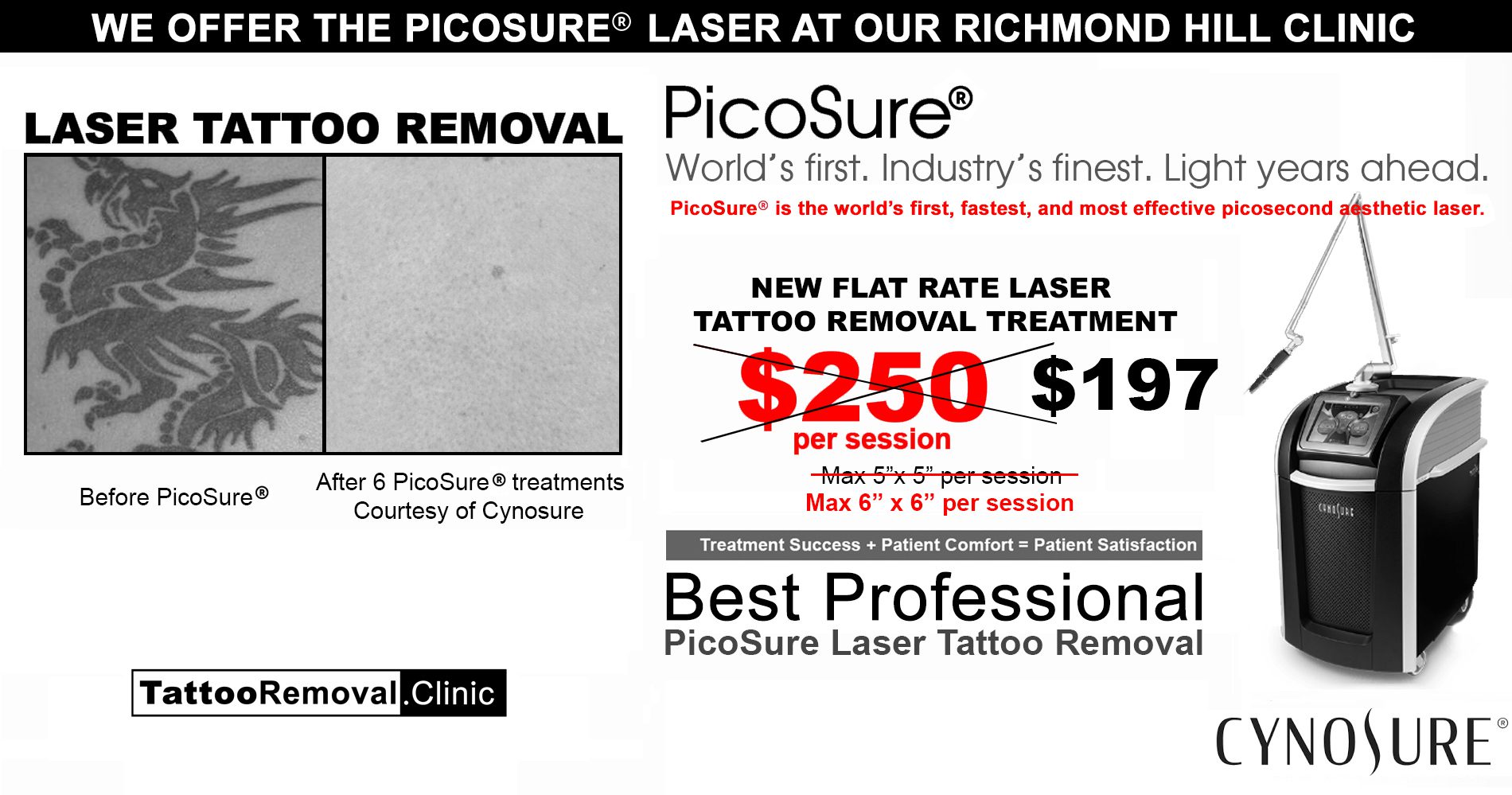 Large tattoo removal cost q switched nd yag laser machine