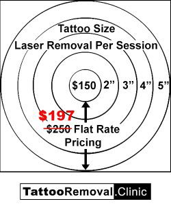 picosure tattoo removal cost toronto