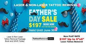 Laser-Tattoo-Removal-Toronto-Tattoo-Removal-Clinic