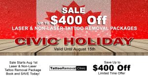 laser tattoo removal Toronto - tattoo removal before and after