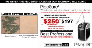 tattoo removal cost - laser tattoo removal Toronto