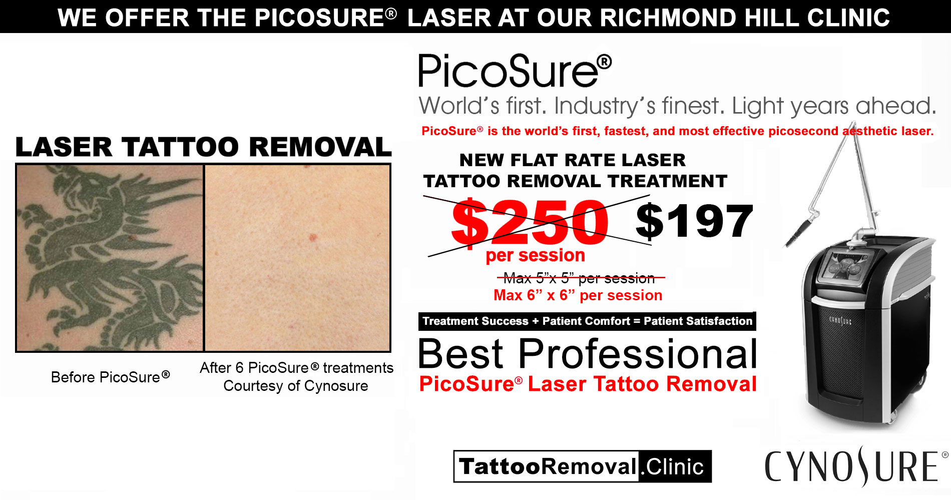 PicoSure Tattoo Removal  City Tattoo Removal