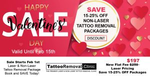Picosure tattoo removal - laser tattoo removal - tattoo removal Toronto