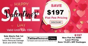 Picosure-tattoo-removal---laser-tattoo-removal---tattoo-removal-Toronto