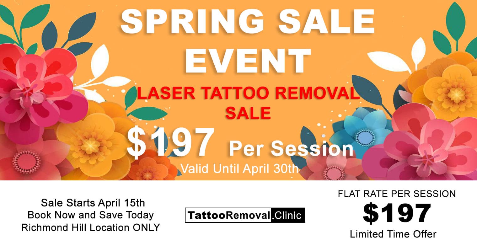 laser-tattoo-removal-Toronto